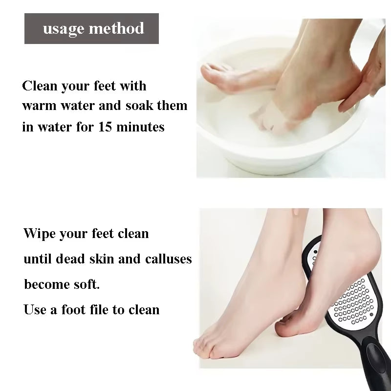 SilkyStep Pro – Double-Sided Stainless Steel Foot File for Callus & Dead Skin Removal